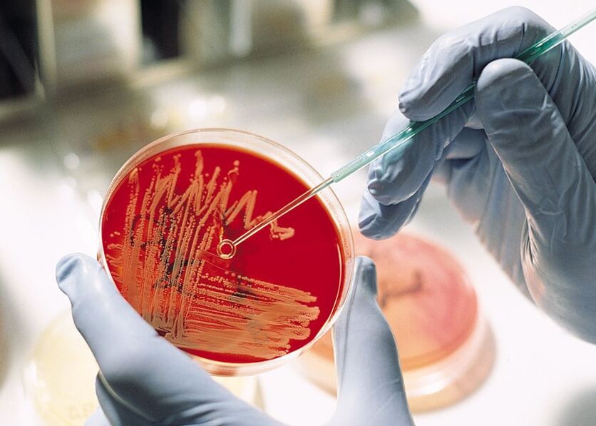 Бактериологична култура на простатна течност за диагностициране на хроничен простатит