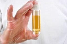 Анализът на урината е един от методите за диагностика на простатит
